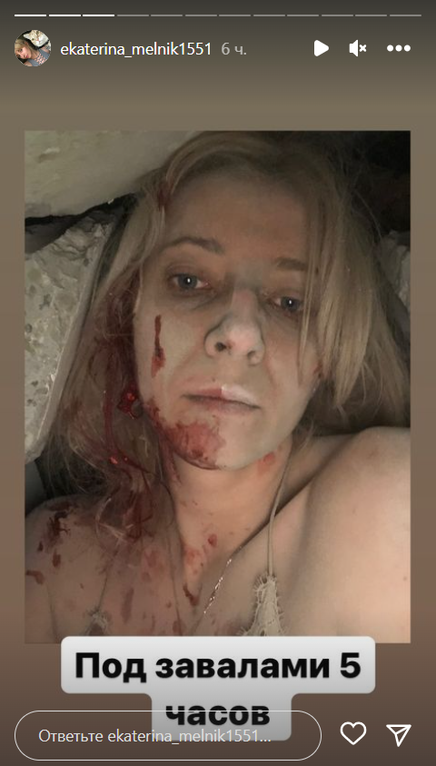 5 годин під руїнами з котиком у руках: жінка дивом вижила після удару РФ по дому в Запоріжжі