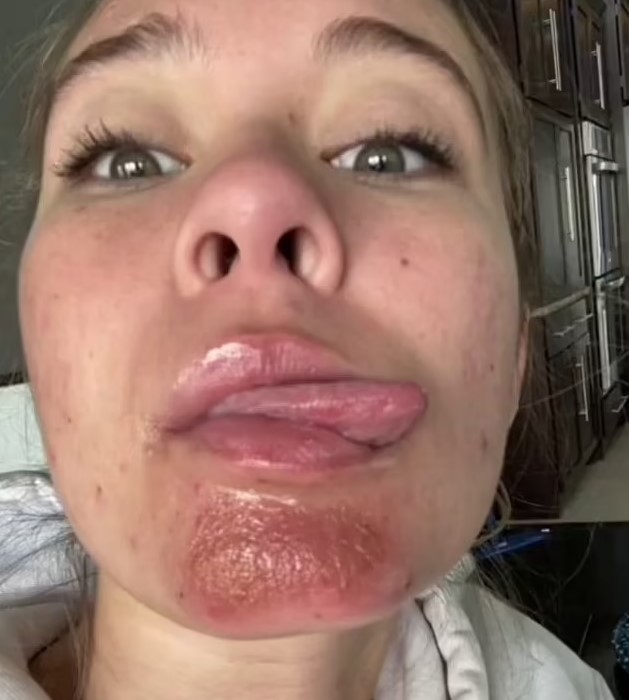 Ось чому стосунки з бородатими чоловіками можуть бути небезпечними