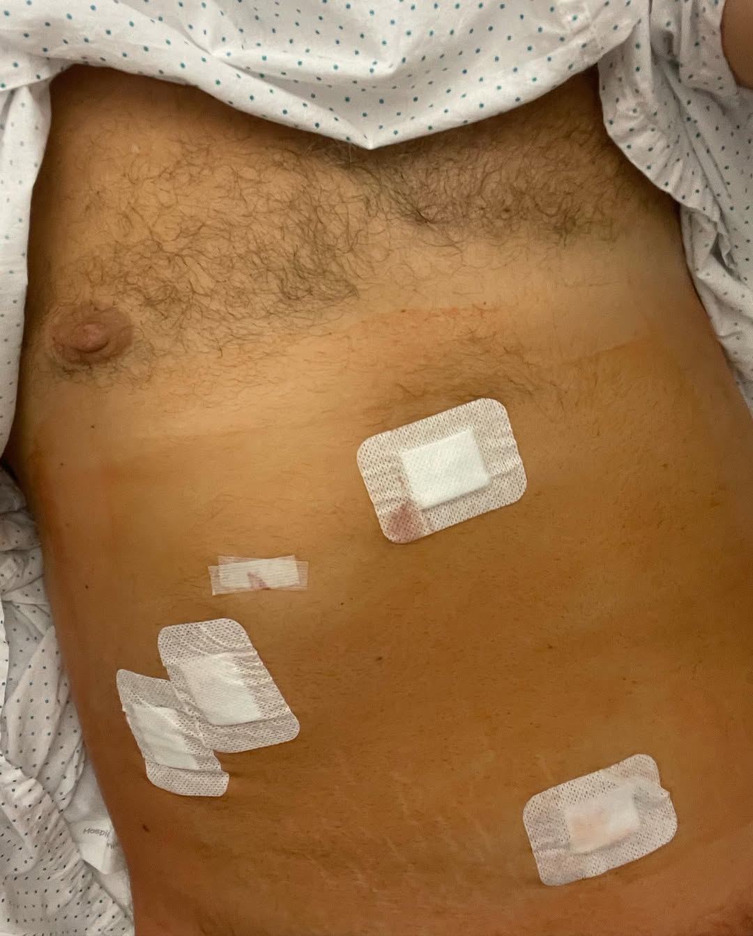 Потап переніс важку операцію і показався у лікарні (фото)