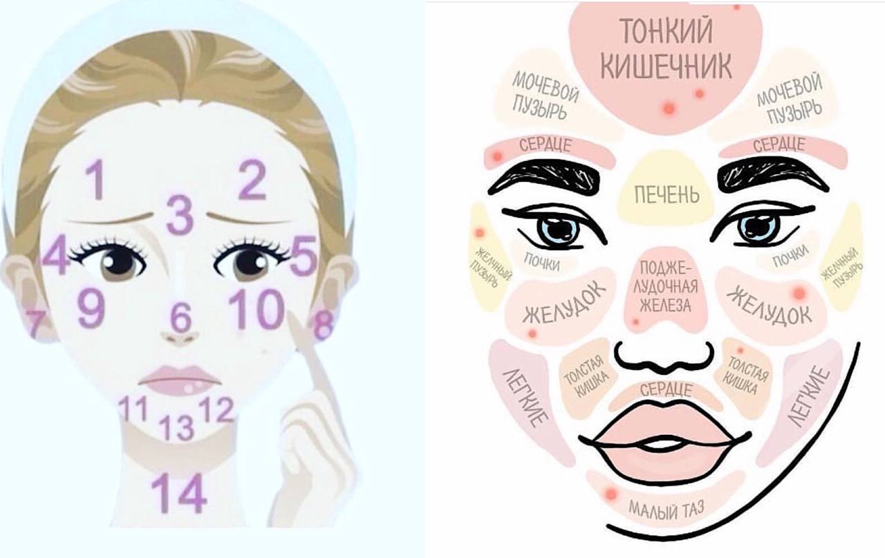 Дерматолог відповіла, чи можна вірити карті акне для обличчя