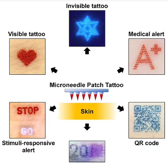 Ученые изобрели пластырь, которым можно делать татуировки за считанные минуты: как он выглядит