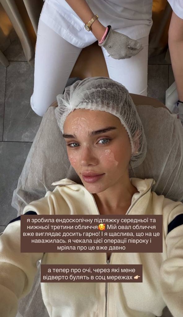 Саша Бо поскаржилася на ускладнення після омріяної "пластики": фото до та після