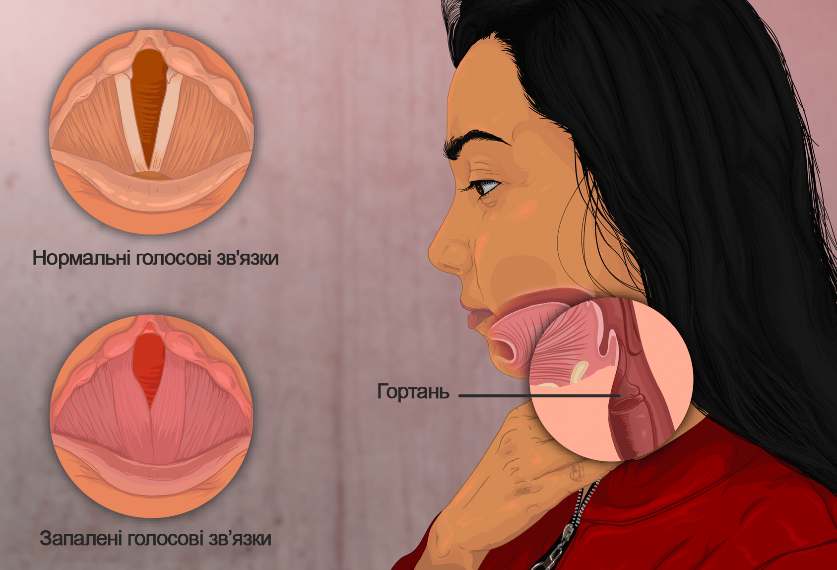 Олег Винник серьезно заболел. На одном концерте за кулисами он упал