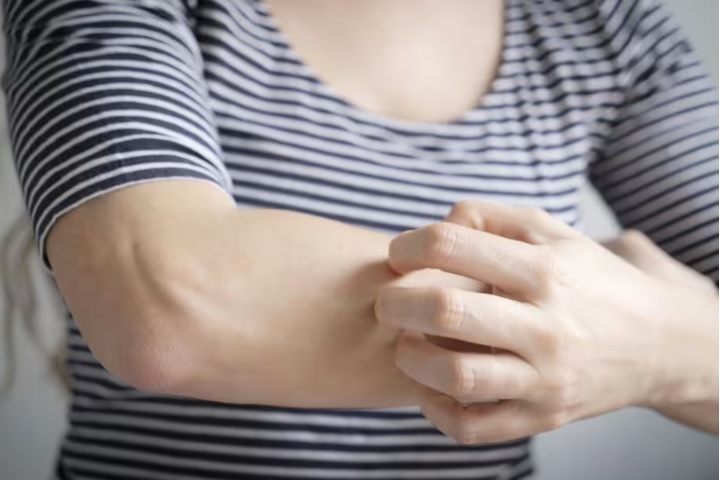 Ці п'ять ознак вкажуть, що ви маєте алергію на алкоголь