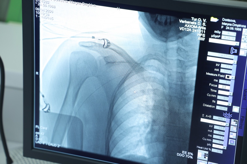 Инфаркты – проблема "номер один" в Украине. Они бывают и в 25: интервью с Георгием Маньковским