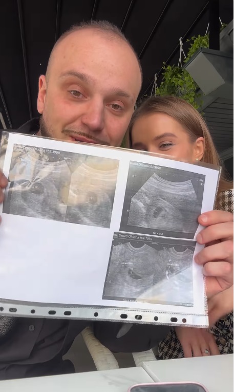 Звезда "МастерШеф" во второй раз станет отцом: что известно