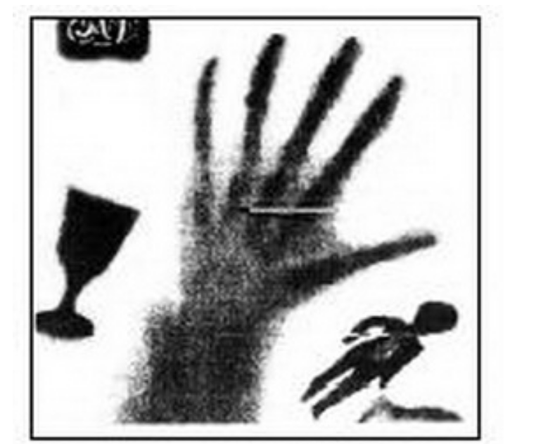 Неймовірні факти про видатного українця, який відкрив Х-промені задовго до Рентгена