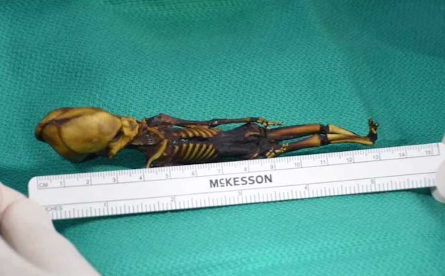 "Гуманоїд Атаками". Як виглядає загадкова крихітна мумія, знайдена науковцями, і що про неї відомо