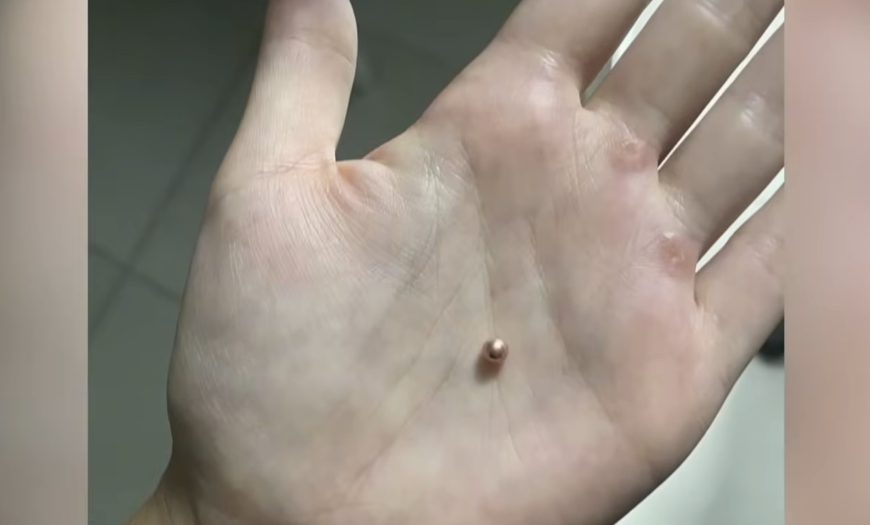 Стріляли по пенсіонерках? Що відомо про конфлікт між жінками й ТЦК у селі на Волині