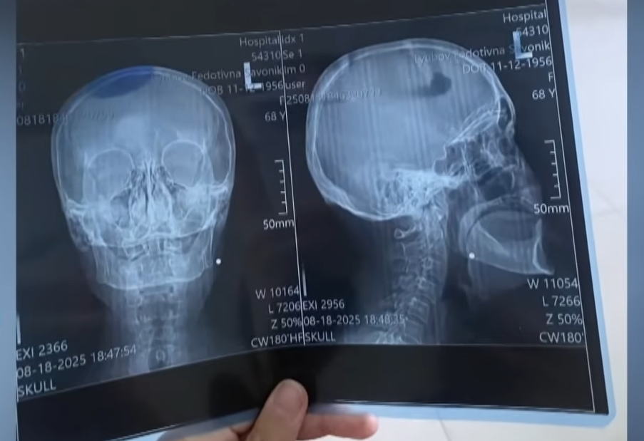 Стріляли по пенсіонерках? Що відомо про конфлікт між жінками й ТЦК у селі на Волині