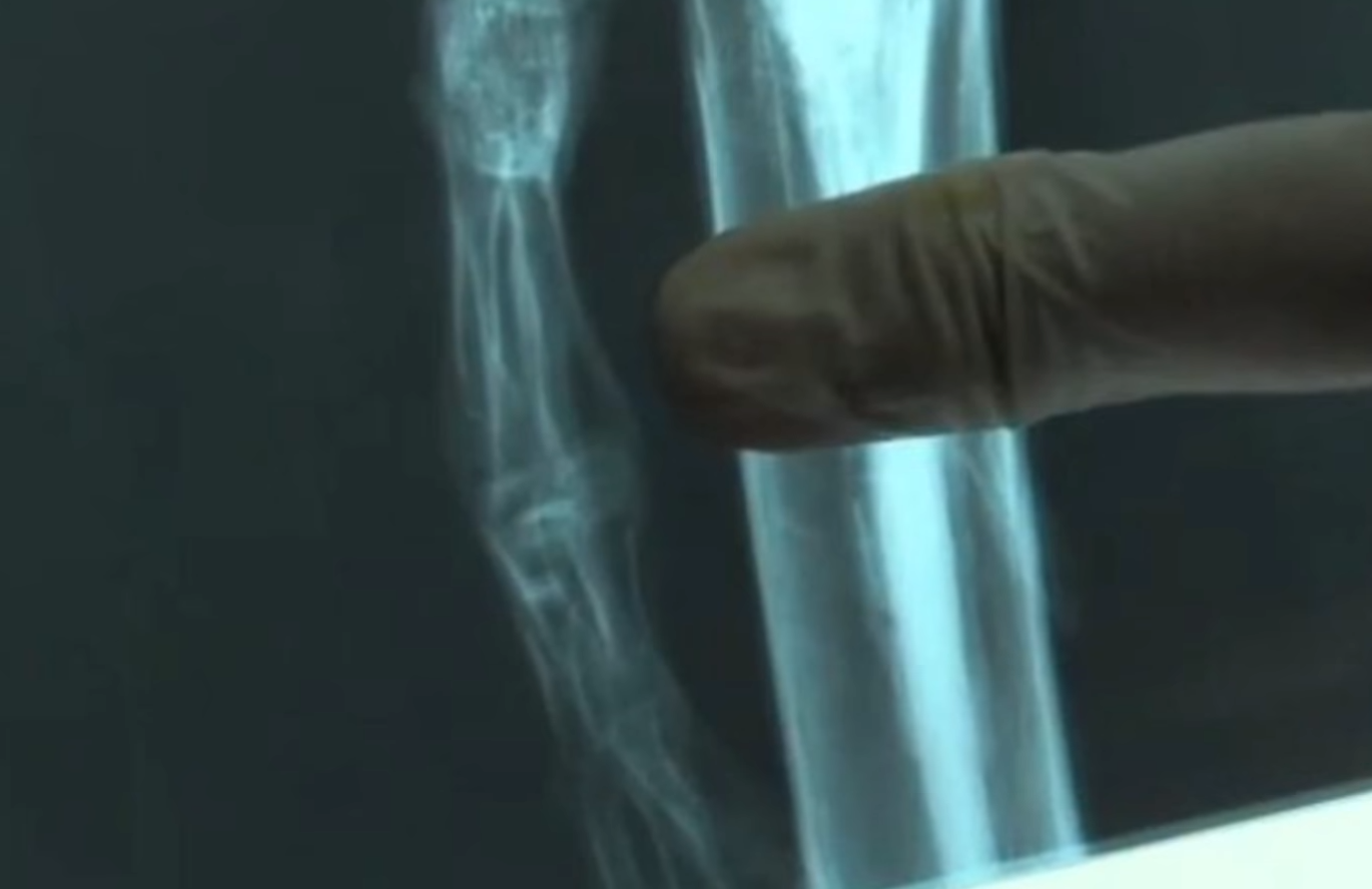 "Гуманоїд Атаками". Як виглядає загадкова крихітна мумія, знайдена науковцями, і що про неї відомо