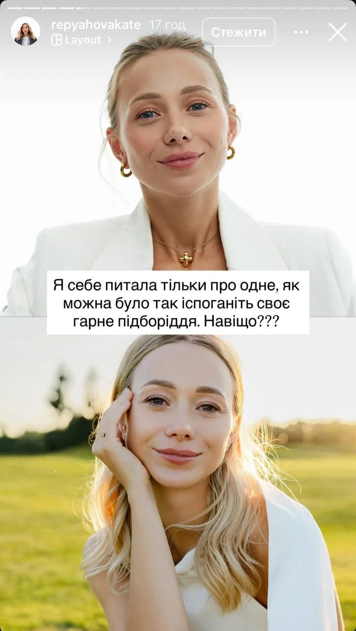 Дружина Павліка шокувала наслідками невдалої пластики: фото до та після