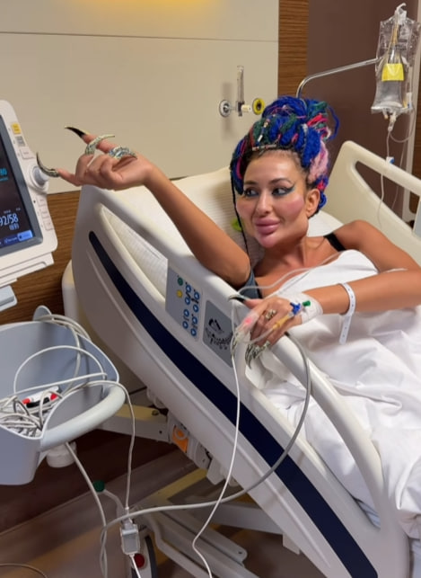 Українка з найбільшими вилицями зробила ще одну "пластику" та показалася після наркозу (фото)