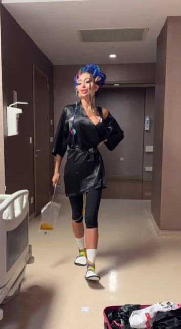 Українка з найбільшими вилицями зробила ще одну "пластику" та показалася після наркозу (фото)