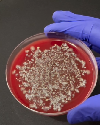 Скільки мікробів на суші. Науковець показав те, що важко "розбачити" (відео)