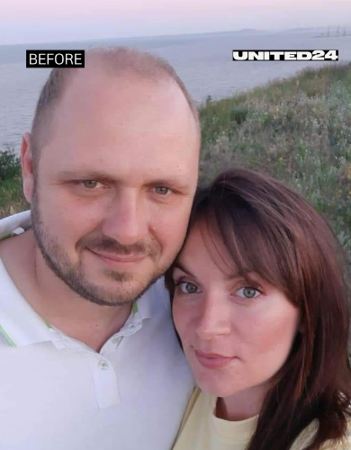 Як виглядає військовий після 20 місяців у російському полоні. Ці фото має побачити увесь світ