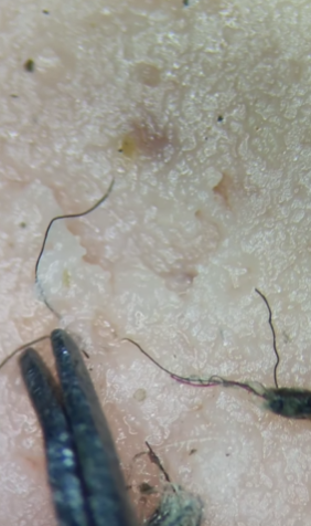 Обычную сосиску показали под микроскопом. Что там "прячется" (видео)