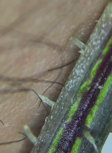 Як "жалить" кропива під мікроскопом. На це відео боляче навіть дивитися