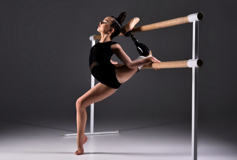 Ворог скалічив, але не зламав. Як сьогодні живе 7-річна гімнастка з протезом Саша Паскаль: сильні фото