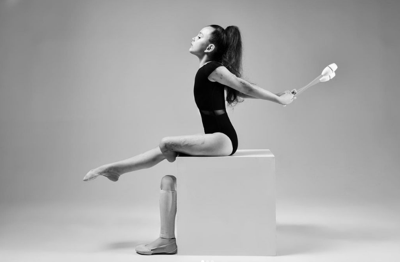 Враг искалечил, но не сломал. Как сегодня живет 7-летняя гимнастка с протезом Саша Паскаль: сильные фото