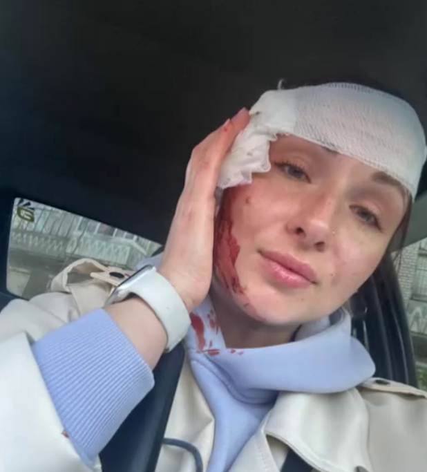 Ракетні атаки на Запоріжжя. Під удар потрапила журналістка (фото)