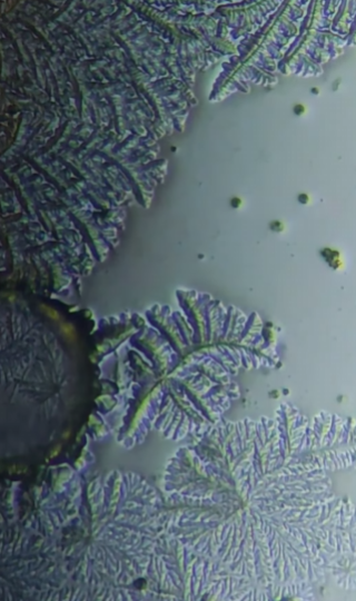 Как выглядит слеза под микроскопом. Такого вы точно не ожидали (видео)