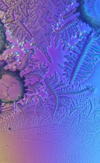 Как выглядит слеза под микроскопом. Такого вы точно не ожидали (видео)