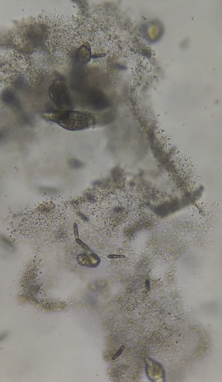 Воду з-під крана показали під мікроскопом, але найбільш "цікавеньке" помітили на аераторі (відео)