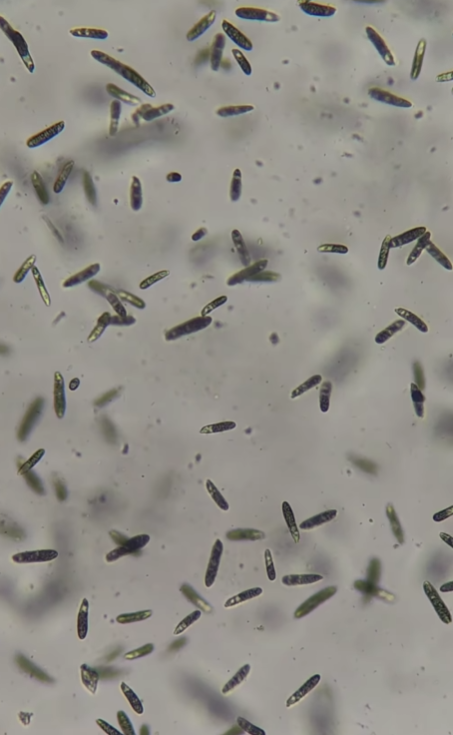 Воду з-під крана показали під мікроскопом, але найбільш "цікавеньке" помітили на аераторі (відео)