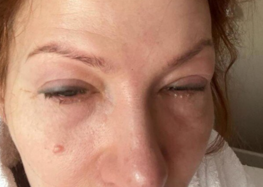 Розпухло обличчя, весь час мучається. Що сталося із зіркою "Маски-шоу", яка зрадила Україну