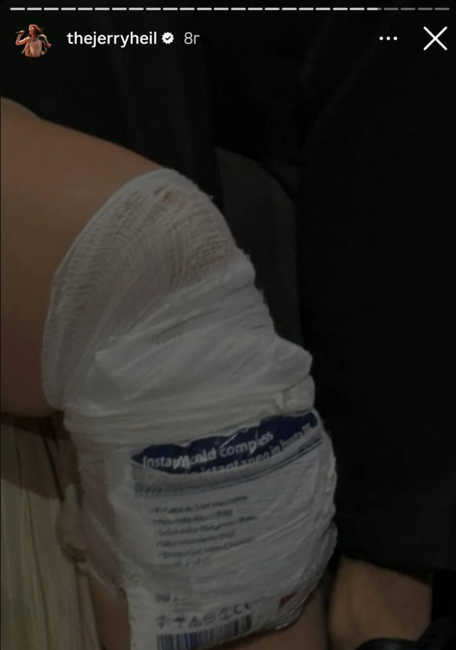 Евровидение 2024. Jerry Heil получила травму во время выступления (фото и видео)