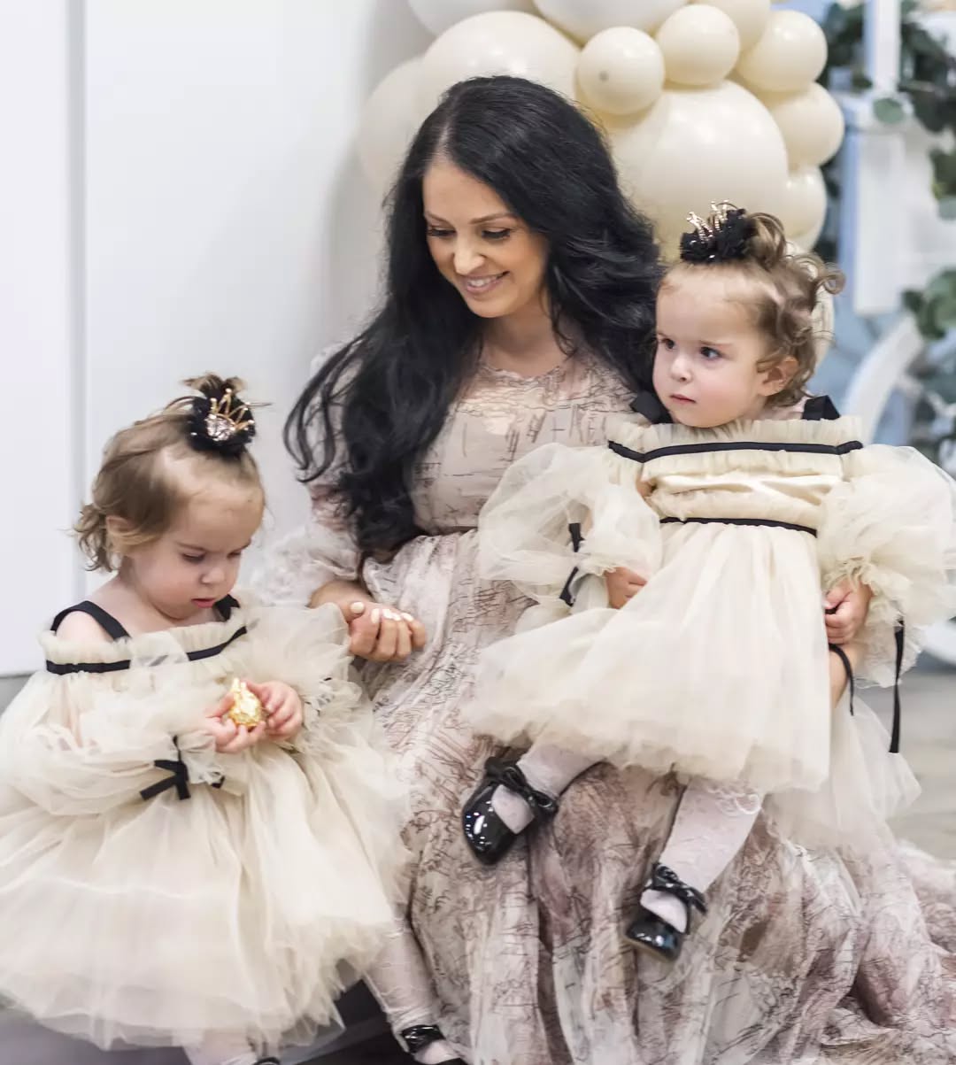 Украинка родила сросшихся близнецов, которым давали минимальные шансы выжить: как они выглядят сейчас