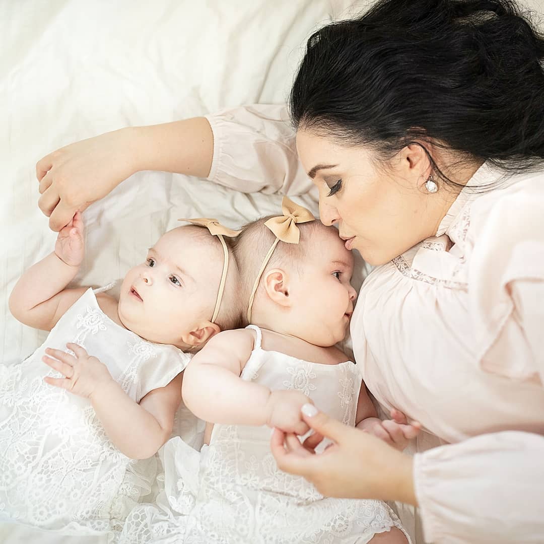 Украинка родила сросшихся близнецов, которым давали минимальные шансы выжить: как они выглядят сейчас