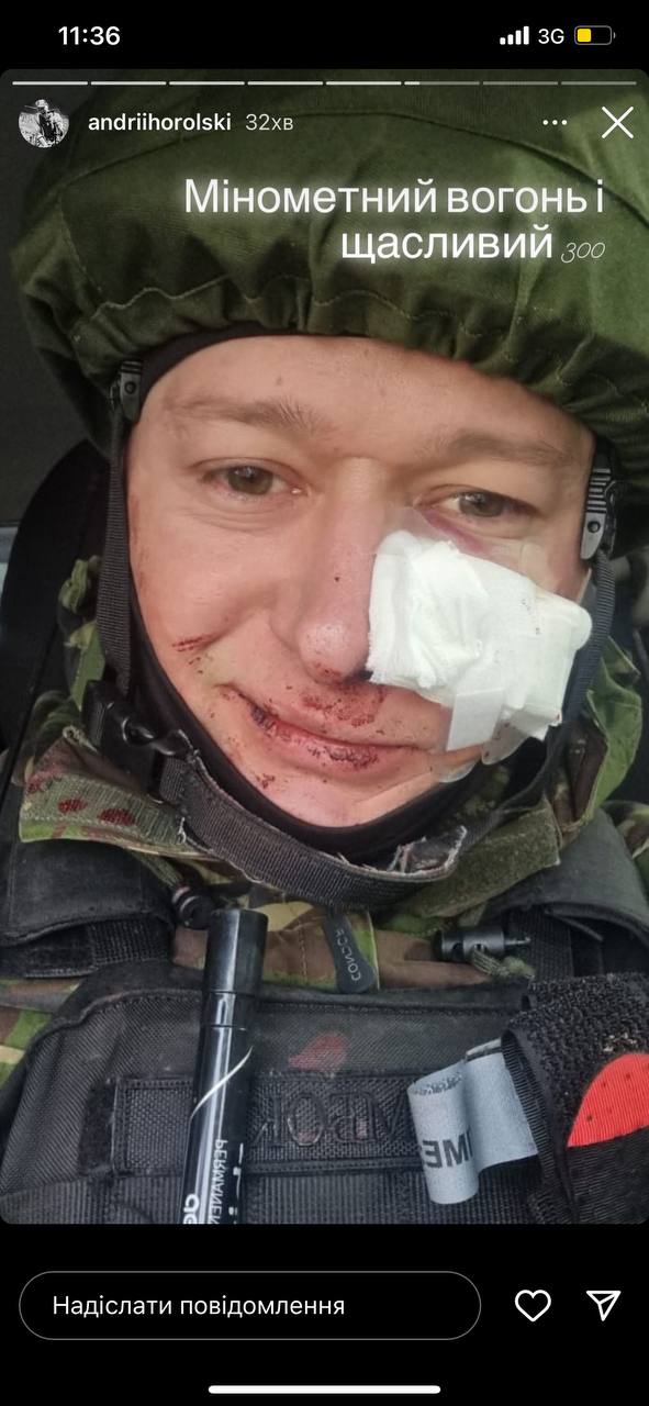 Андрей Хлывнюк попал под минометный обстрел: он ранен