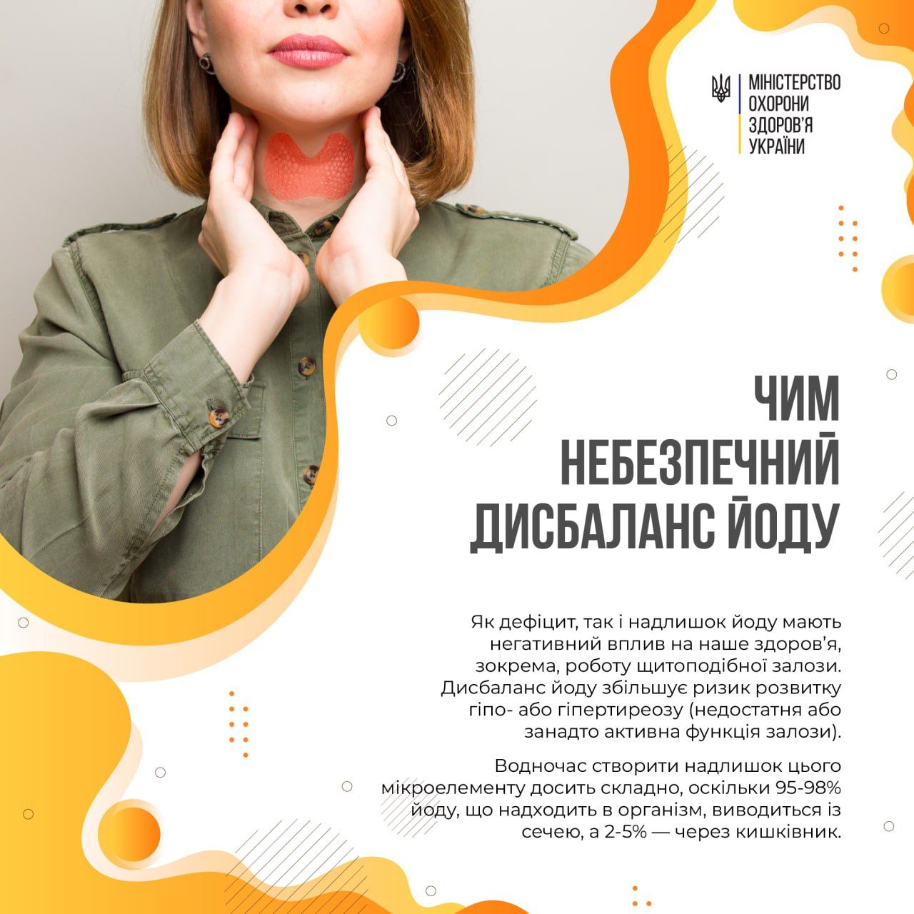 Кому потрібно стежити за рівнем йоду в організмі: у МОЗ назвали категорії українців