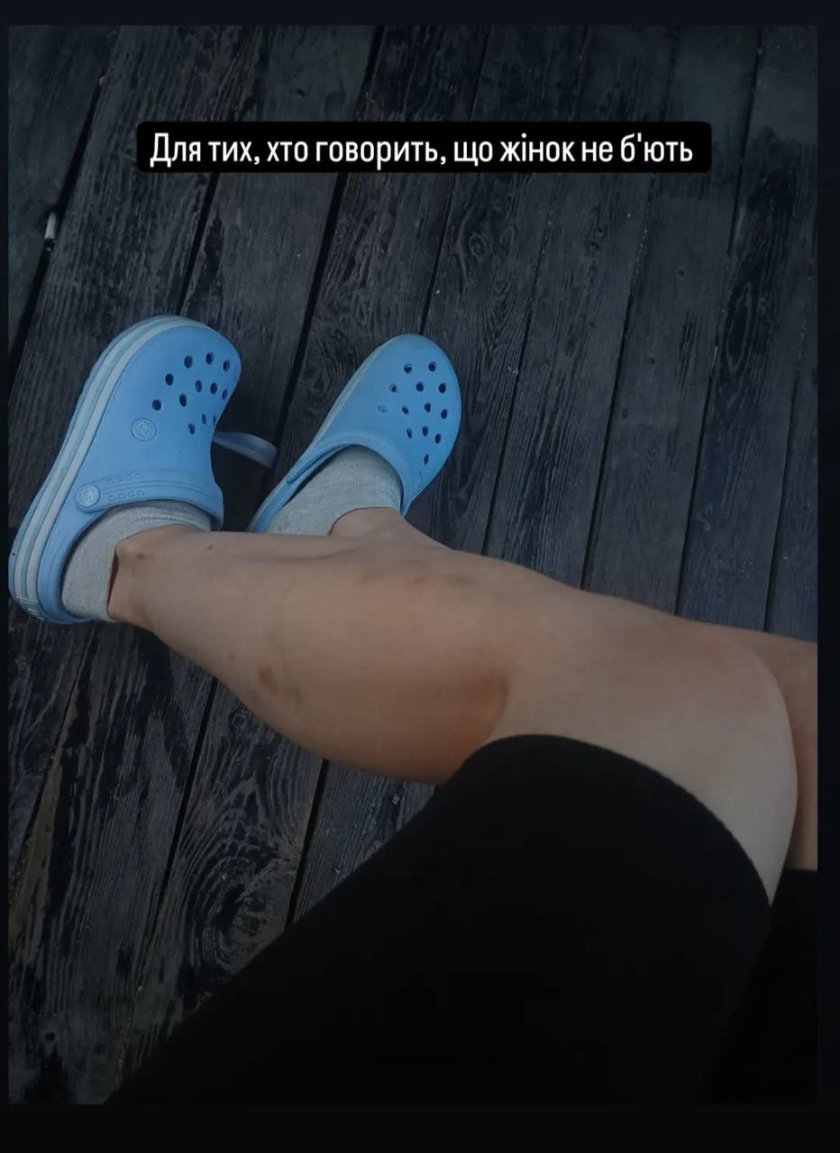 Звільнена з полону слідча Мар'яна Чечелюк вперше за два роки побачила маму: щемливе відео до сліз