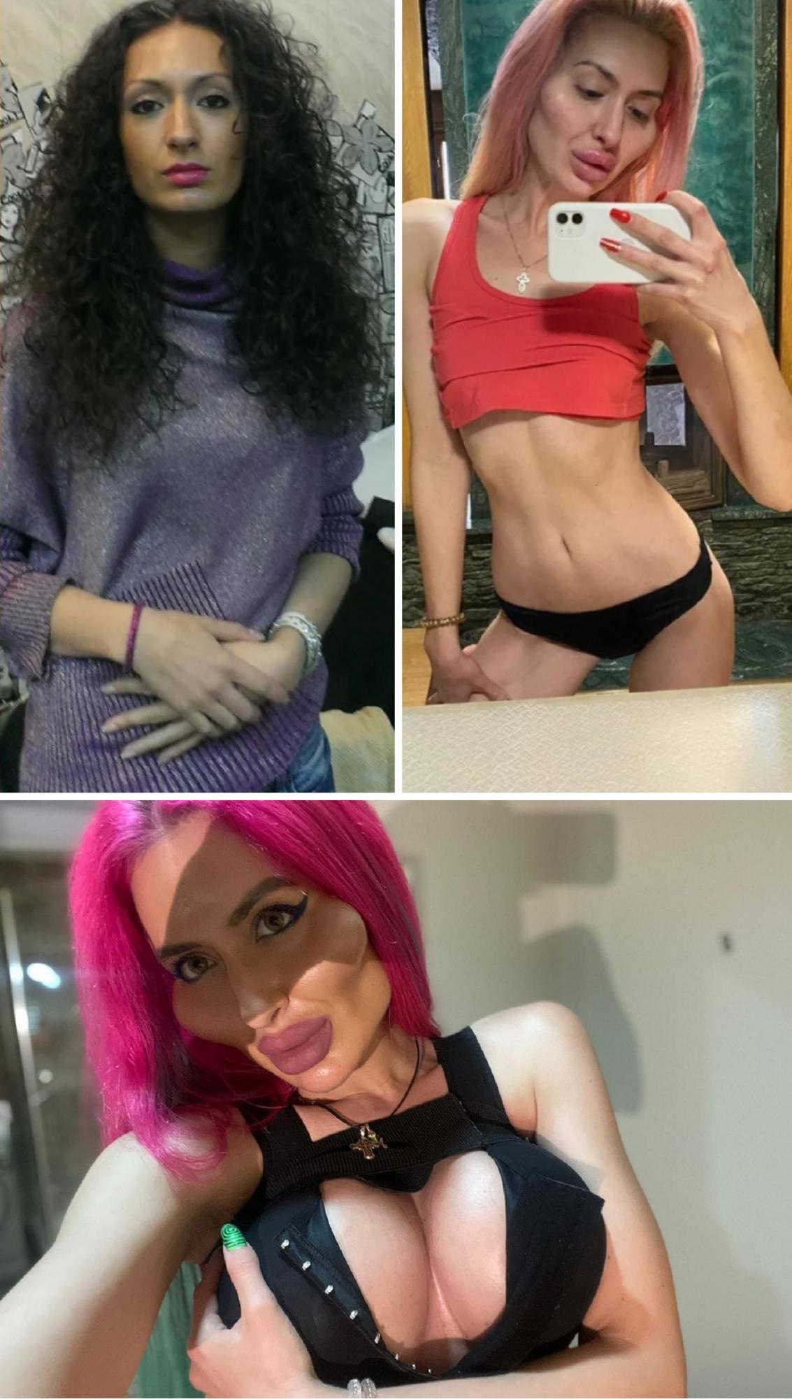 Эпатажная украинская блогер с гигантскими скулами еще больше "выросла": фото до и после