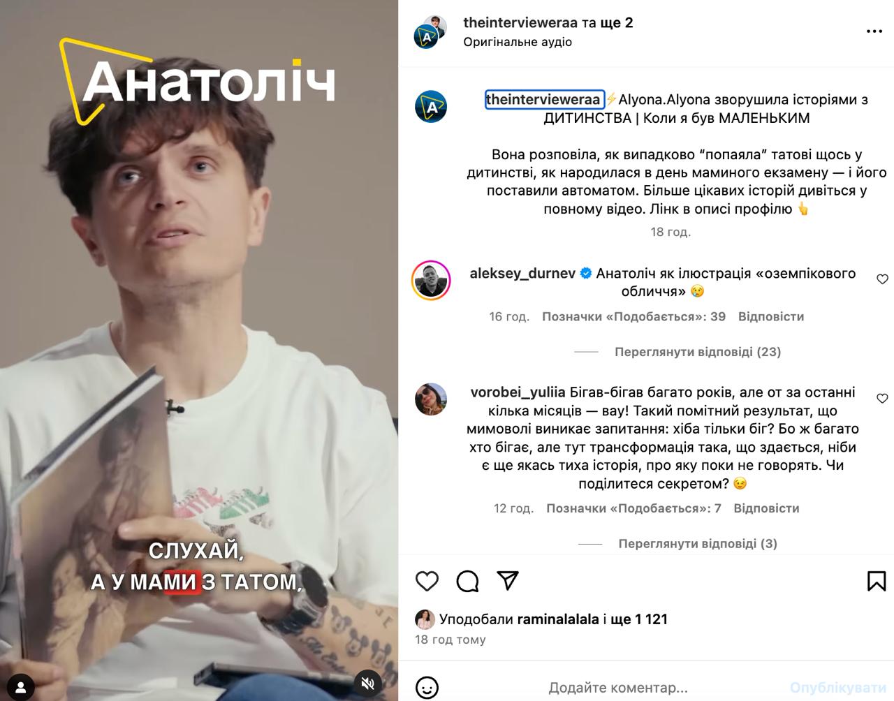 Дурнєв нарвався на критику Анатоліча після жартів про "Оземпік": згадали всі "гріхи" (відео)