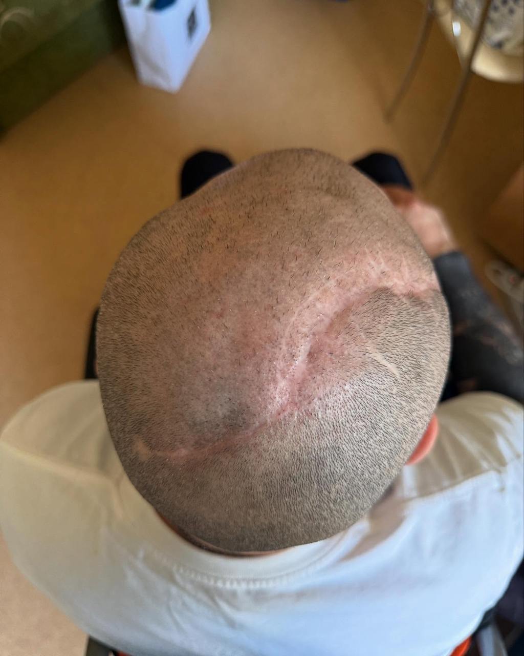 Розовий з "Ліги сміху" зізнався, як живе після важкого поранення: "Думали, що не протягну і 10 днів"