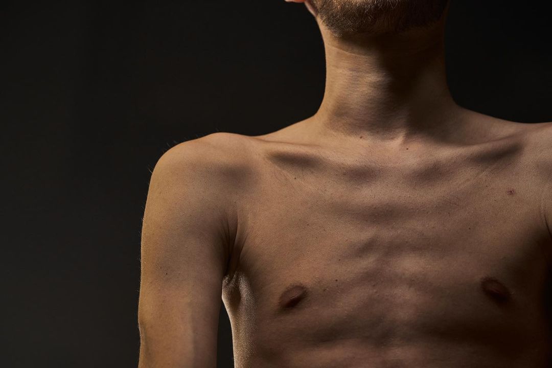 Худий та змучений: у мережі з'явилися фото "Ореста" з Азовсталі після полону