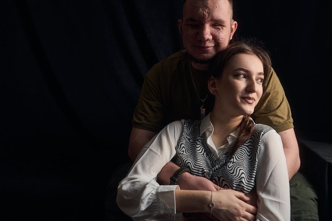 "Наречена підтримує з перших днів". Чуттєва історія Влада, який втратив очі, захищаючи Україну
