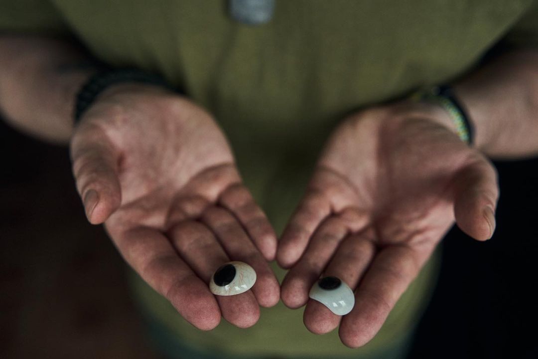 "Наречена підтримує з перших днів". Чуттєва історія Влада, який втратив очі, захищаючи Україну