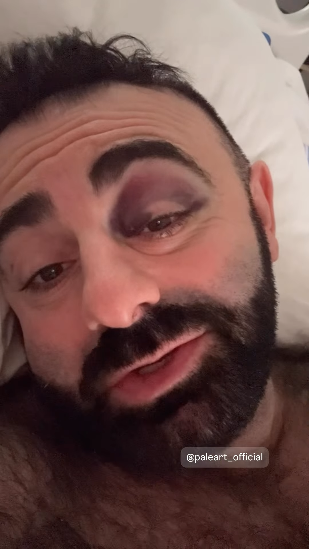 Популярный украинский актер попал в больницу с травмой черепа: что известно