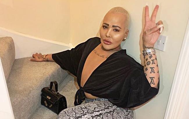 "Как Ким Кардашьян": парень провел 80 операций, чтобы превратиться в своего кумира