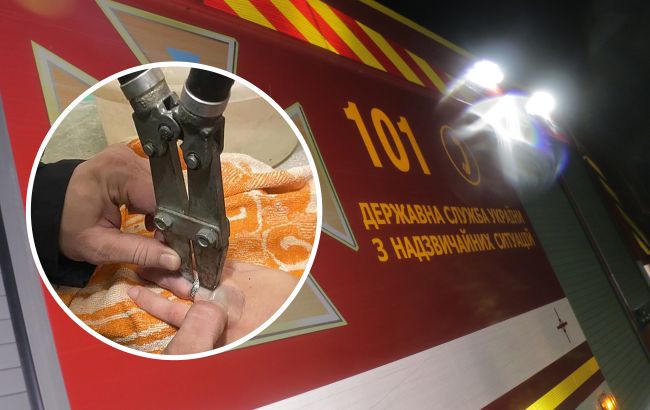 У Дніпрі жінка викликала рятувальників, щоб допомогли їй зняти каблучку: що вони зробили