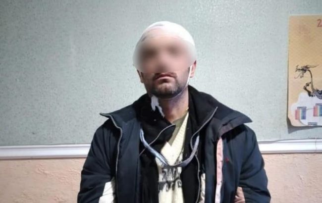 Приезжий и имел конфликт с директором: что известно о поджигателе "Эпицентра"