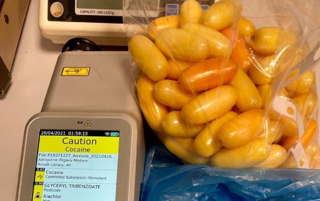 В Киеве таможенники задержали иностранца с кокаином в животе. Наркотики изымали 19 часов
