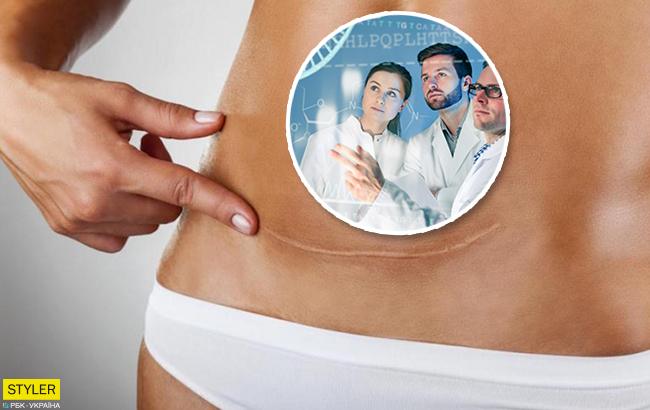 Кесарево сечение: ученые обнаружили еще одно последствие этой операции