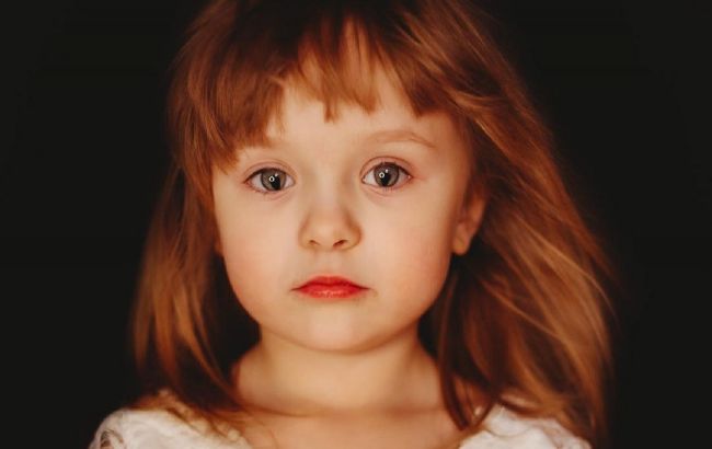 Вот как выглядят люди с генетическим дефектом глаз, который делает взгляд "змеиным"