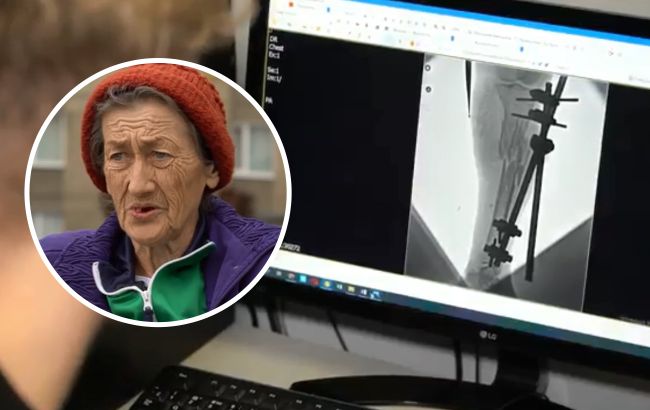 "Рідним сказали, що я загинула": у Львові врятували життя жінці з Бахмута